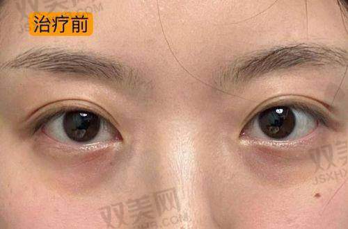 结 语：一眼年轻十岁不是神话，这次就让眼睛赢回来！