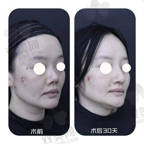 维恩适合你吗？从用户画像来看答案