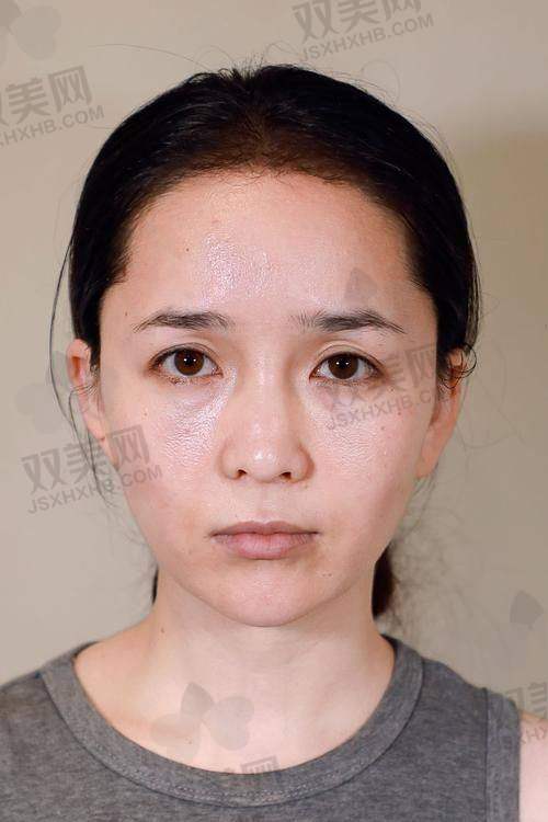 术后成效和修复情况