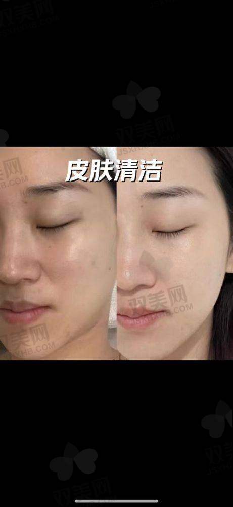后续的回访和感受