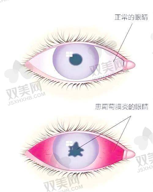 【保定新视眼科医院怎么样】