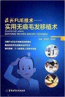 【昆明源生植发医院电话号码是多少】