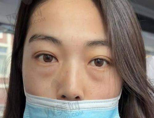 到店面诊：医生1对1，设计方案特别细