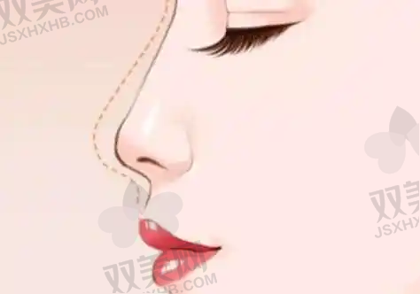 眼部整形价格详表