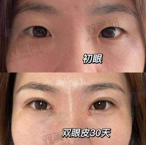 手术过程