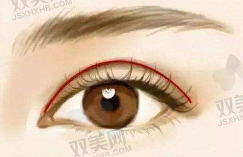 术后修复