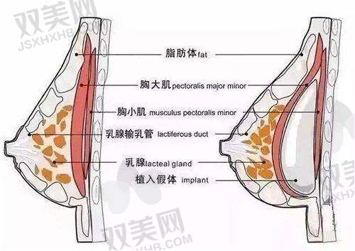 花88000在重庆艺星找朱家旭做法国优丝丽隆胸，分享他隆鼻案例及隆鼻效果体验