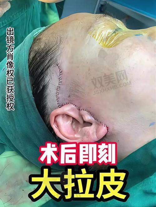 一、术前的纠结与选择