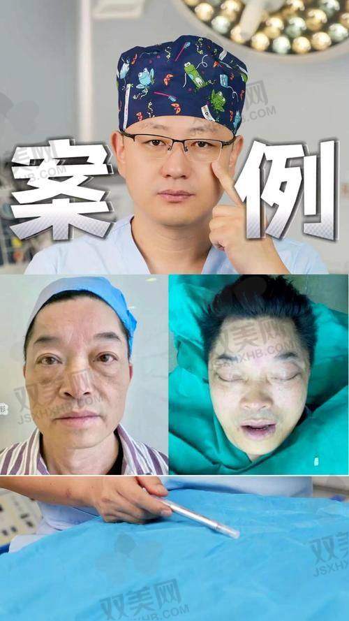 术后的修复与惊喜
