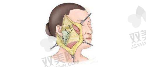 三、术后修复与成效