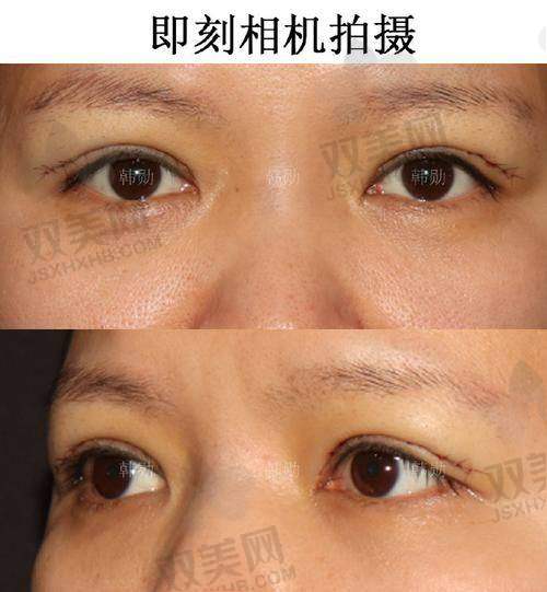 怎么挂号吕方中医生？别错过优惠季节