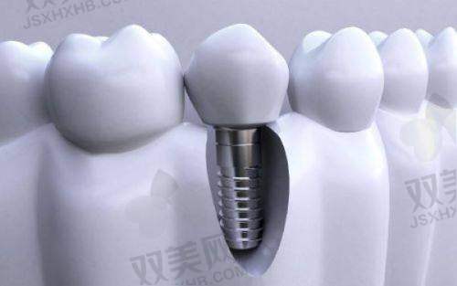 补牙 & 拔牙：日常常规类项目价格明晰