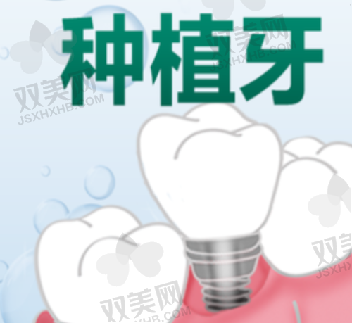 价格不止看数字，适配才是硬道理！品牌选择Tips→
