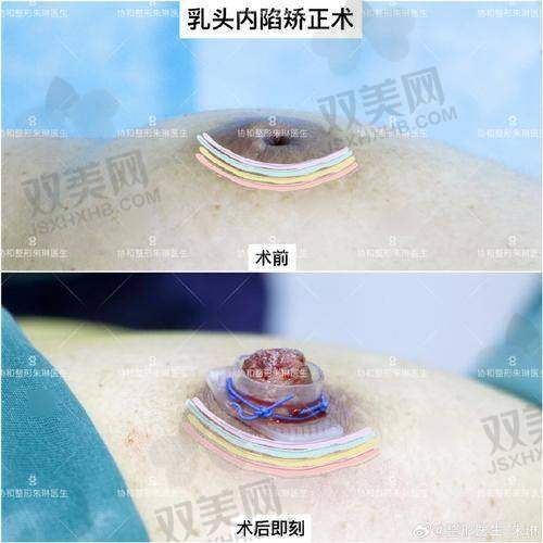 【昆明海木医疗美容医院怎么样】