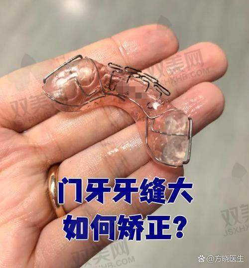 三、对比分析：为何说“深圳格伦菲尔口腔收费太贵”其实是个大误会？