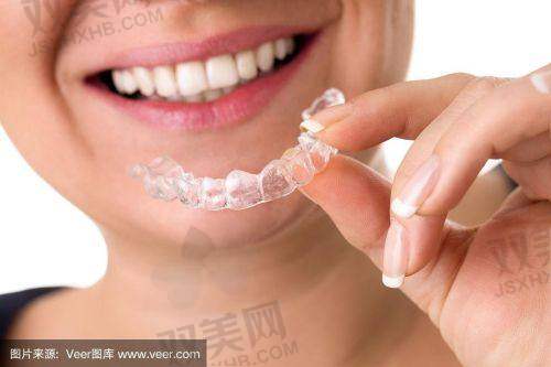 2. 可丽尔牙套都有哪些系列？价格多少钱？