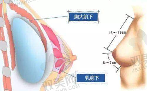 对比不同牙套品牌