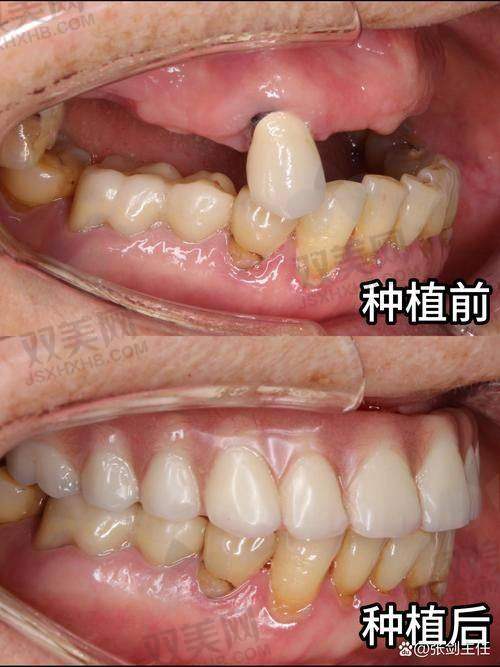 北京牙元素口腔医院其他信息