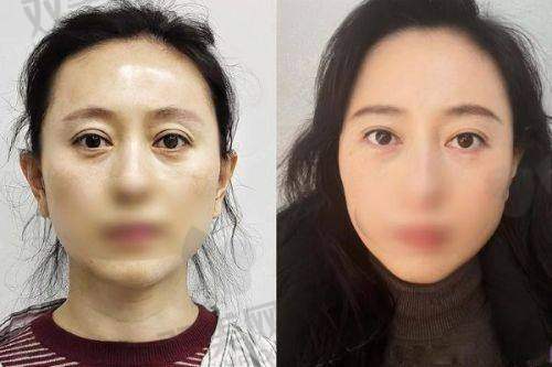 NO.3 杨丽 - 郑州杨丽美颜医疗美容医院