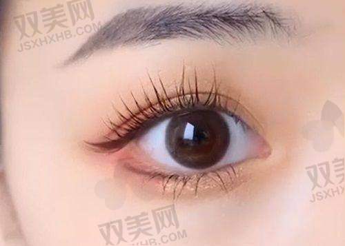 胡彬——“动静皆宜”眼部设计理念，柔美与立体兼得