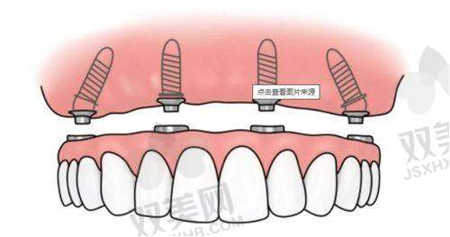 【合肥泰康拜博口腔医院仪器设备有哪些】