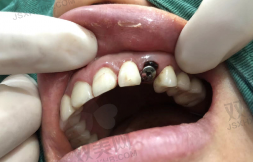 4. 福清茉莉口腔