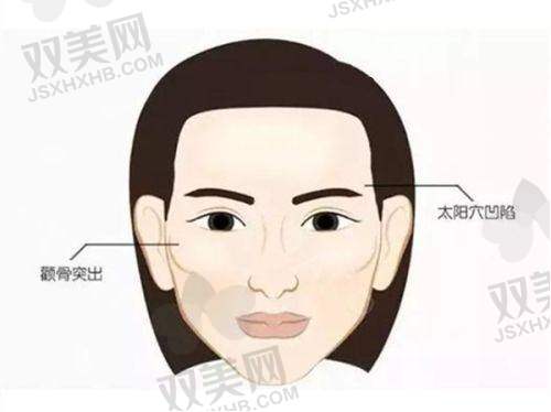 整脸填充后的修复过程是怎样的