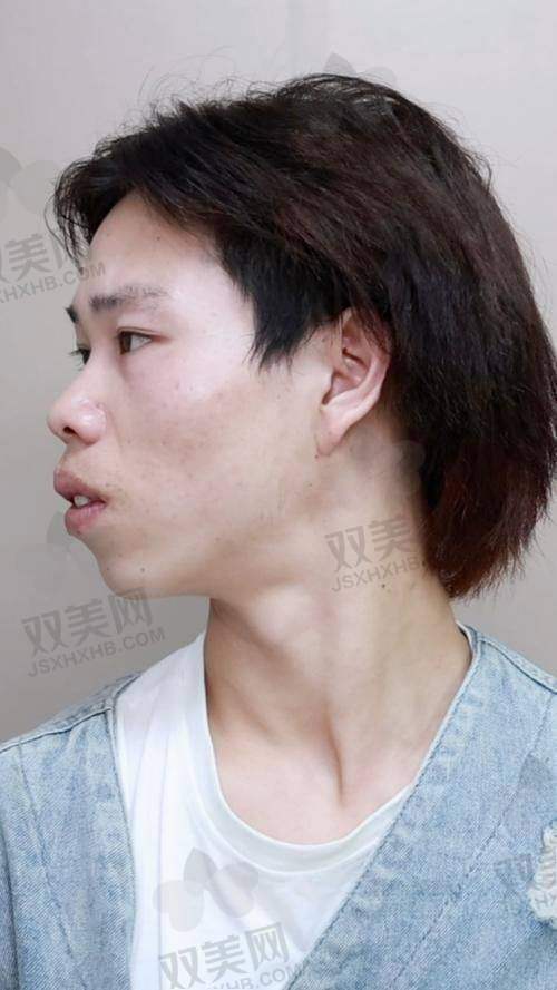 佛山禅城中 心医院整形外科中 心的热门项目及参考价格