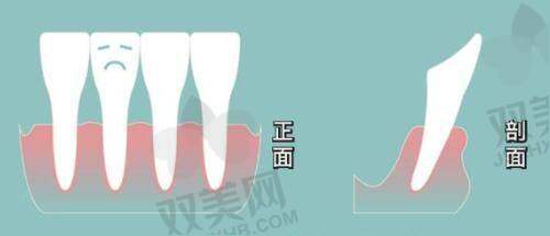 全文总结与资讯欲望引发