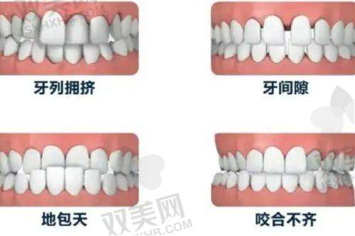 三、医生团队“含金量”如何？种植正畸谁比较强？