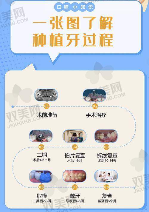 韩国科威尔种植牙的价格范围，贵吗？