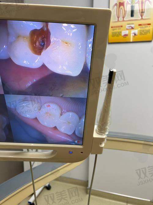 如何选择适合自己的树脂材料