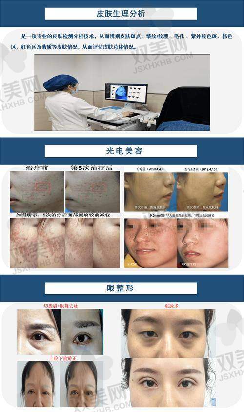 术后护理小贴士