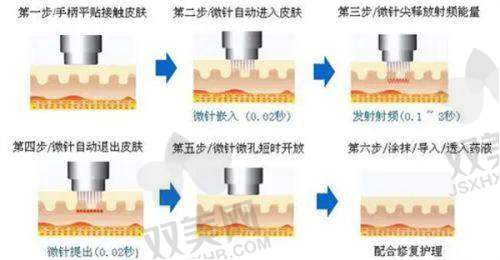 术前准备，严谨细致
