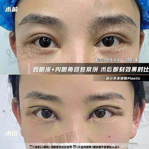【喀什悦美医疗美容诊所怎么样】