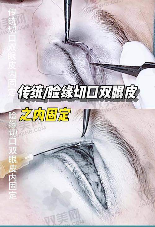 【韩国清潭FIRST整形外科地址及乘车路线】