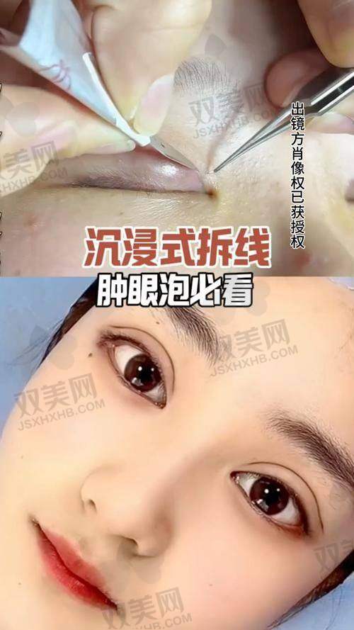 【韩国清潭FIRST整形外科营业时间是什么时候】