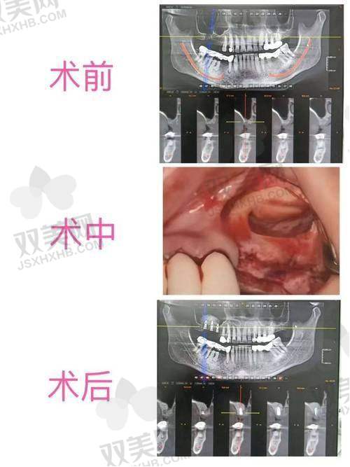 【韩国Faceline整形外科怎么预约挂号】