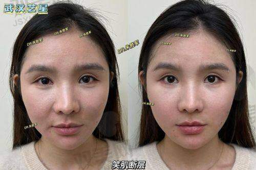 赫莱丽 vs 赫伊莎：姐妹打架谁更胜一筹？