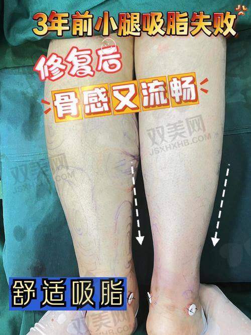 五、复胖免吸的保护太贴心