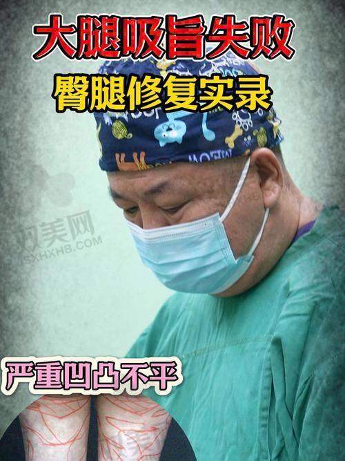 一、我的“肉肉”烦恼