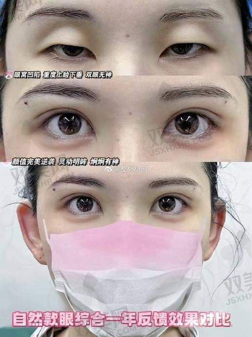面诊体验