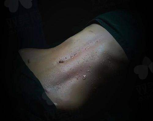 术后修复情况