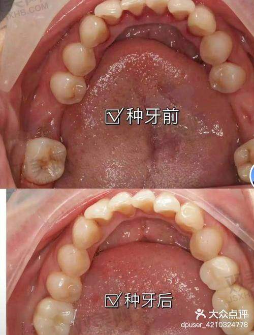 【北京拜博口腔公主坟门诊部地址】