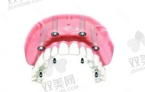 【北京拜博口腔呼家楼门诊部擅长什么项目】