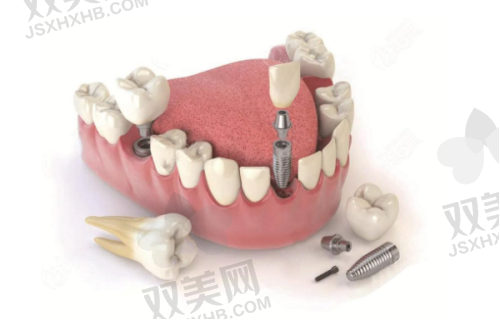 【北京拜博口腔呼家楼门诊部怎么预约挂号】
