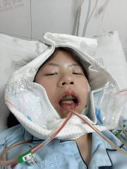【韩国theface整形医院电话号码是多少】