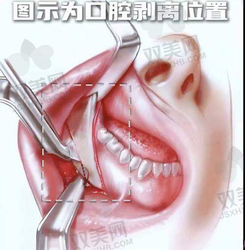 【韩国theface整形医院地址及乘车路线】