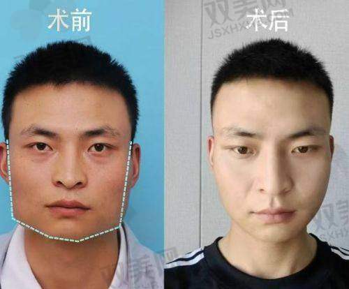【韩国theface整形医院是私立还是公办】