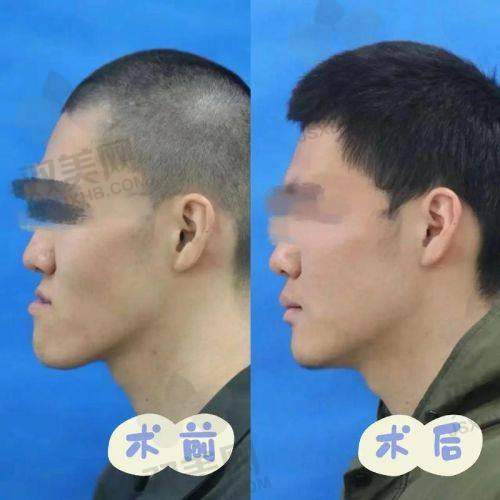 结语：别让“嘴里的小问题”，拖成“脸上的大缺陷”